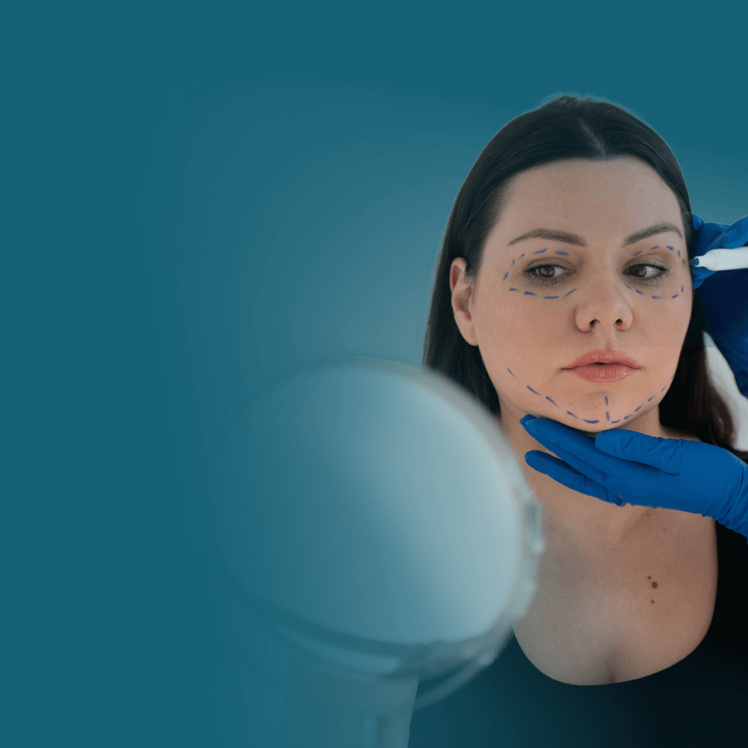 Imagen promocional de Campaña 17